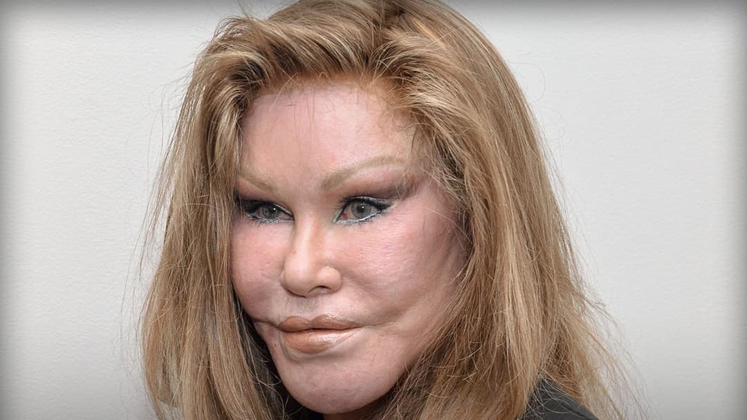 Jocelyn Wildenstein: The Life and Legacy of the "Catwoman" Icon